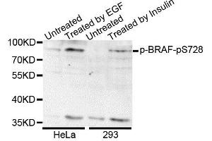 Western blot analysis of extracts of various cell lines, using Phospho-BRAF-S728 antibody. (BRAF 抗体  (pSer728))