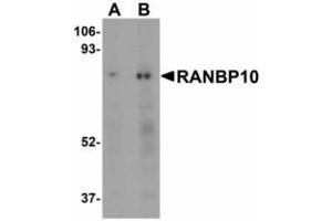 Image no. 1 for anti-RAN Binding Protein 10 (RANBP10) (Internal Region) antibody (ABIN478260) (RANBP10 抗体  (Internal Region))