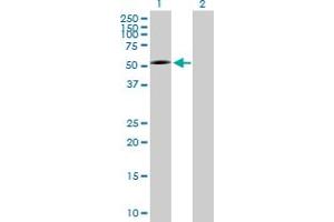 Western Blot analysis of P2RX5 expression in transfected 293T cell line by P2RX5 MaxPab polyclonal antibody. (P2RX5 抗体  (AA 1-422))