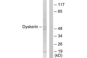 Western Blotting (WB) image for anti-Dyskeratosis Congenita 1, Dyskerin (DKC1) (Internal Region) antibody (ABIN1849014) (DKC1 抗体  (Internal Region))