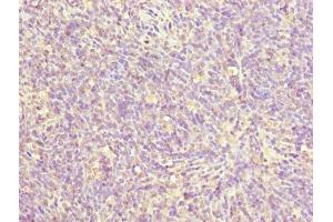 Immunohistochemistry of paraffin-embedded human thymus tissue using ABIN7176109 at dilution of 1:100 (ZNF131 抗体  (AA 80-379))