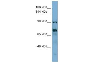 WB Suggested Anti-TMEM146 Antibody Titration: 0. (TMEM146 抗体  (Middle Region))