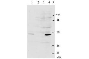 Western Blotting (WB) image for anti-Human Papilloma Virus Type 11 (HPV-11) (AA 202-284) antibody (ABIN781775) (人 Papilloma Virus Type 11 (HPV-11) (AA 202-284) 抗体)
