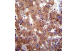 Immunohistochemistry analysis in formalin fixed and paraffin embedded human liver tissue reacted with 17-beta-HSD4 / HSD17B4 Antibody (Center) followed which was peroxidase conjugated to the secondary antibody and followed by DAB staining.