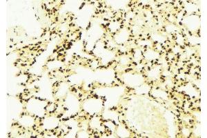 ABIN6279147 at 1/100 staining Mouse lung tissue by IHC-P. (ATXN7 抗体  (Internal Region))
