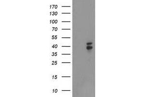 Western Blotting (WB) image for anti-NudE Nuclear Distribution E Homolog (A. Nidulans)-Like 1 (NDEL1) antibody (ABIN1499853) (NDEL1 抗体)