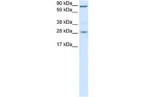 WB Suggested Anti-BCL2 Antibody Titration:  0. (Bcl-2 抗体  (N-Term))