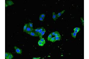 Immunofluorescent analysis of HepG2 cells using ABIN7160472 at dilution of 1:100 and Alexa Fluor 488-congugated AffiniPure Goat Anti-Rabbit IgG(H+L) (MYD88 抗体  (AA 1-282))