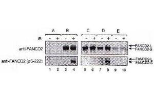 FA-D2 fibroblasts were stably transfected with either pMMP (empty vector, A), FANCD2 (wt, B), FANCD2 (S222A, C), FANCD2 (triple mutant, D), or FANCD2 (quadruple mutant, E). (FANCD2 抗体  (pSer222))
