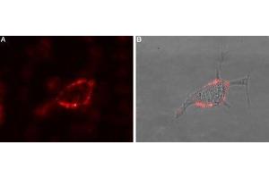 Immunocytochemistry (ICC) image for anti-gamma-aminobutyric Acid (GABA) Receptor, theta (GABRQ) (AA 131-143), (Extracellular) antibody (ABIN7043197)