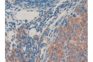 DAB staining on IHC-P; Samples: Mouse Ovary Tissue (MTA1 抗体  (AA 6-218))
