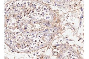 ABIN5539530 (4µg/ml) staining of paraffin embedded Human Testis. (Acrosin 抗体  (Internal Region))