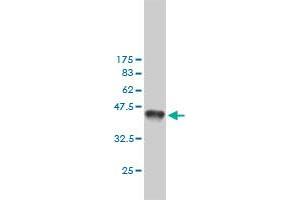 Western Blot detection against Immunogen (36. (MSH6 抗体  (AA 931-1030))