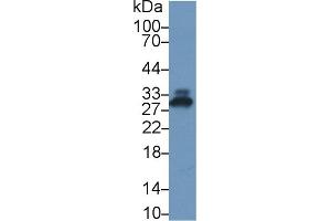 Detection of CRP in Rat Serum using Polyclonal Antibody to C Reactive Protein (CRP) (CRP 抗体  (AA 20-225))