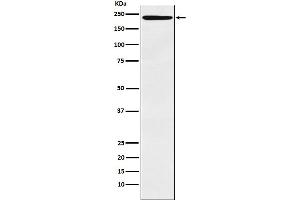 Western blot analysis of LY75 expression in Human tonsil lysate.