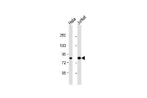 All lanes : Anti-CHUK Antibody (C-term) at 1:1000 dilution Lane 1: Hela whole cell lysate Lane 2: Jurkat whole cell lysate Lysates/proteins at 20 μg per lane. (IKK alpha 抗体  (C-Term))
