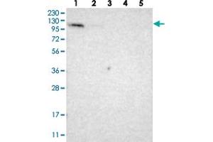 Western blot analysis of Lane 1: RT-4, Lane 2: U-251 MG, Lane 3: Human Plasma, Lane 4: Liver, Lane 5: Tonsil with LONP2 polyclonal antibody . (LONP2 抗体)