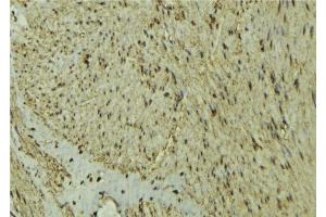 ABIN6277295 at 1/100 staining Mouse muscle tissue by IHC-P. (MEF2C 抗体  (C-Term))