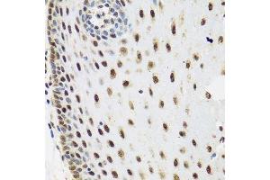 Immunohistochemistry of paraffin-embedded human esophagus using SKIV2L2 antibody. (MTR4 抗体  (AA 1-304))