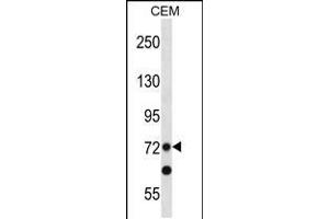 Western blot analysis in CEM cell line lysates (35ug/lane). (PRDM8 抗体  (N-Term))