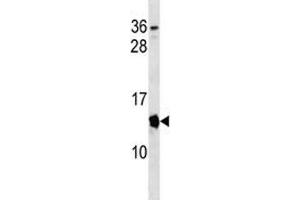 Cdkn2a antibody western blot analysis in mouse spleen tissue lysate. (CDKN2A 抗体  (AA 39-65))