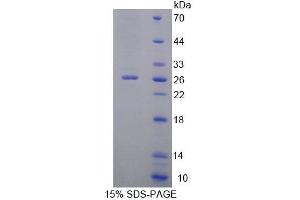 SDS-PAGE analysis of Human ZRF1 Protein. (DNAJC2 蛋白)