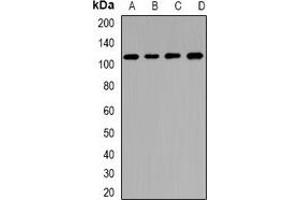 Western blot analysis of CNGA3 expression in BT474 (A), U87 (B), mouse pancreas (C), rat liver (D) whole cell lysates. (CNGA3 抗体)
