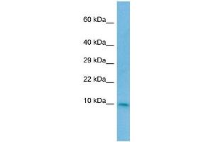 WB Suggested Anti-CC2D2A Antibody Titration: 1. (CC2D2A 抗体  (N-Term))