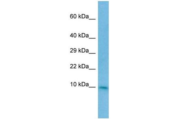 CC2D2A 抗体  (N-Term)
