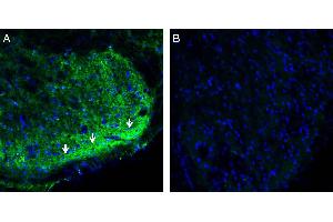 Expression of CRMP2 in rat spinal cord. (DPYSL2 抗体  (Intracellular))