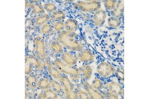 Immunohistochemistry of paraffin-embedded rat kidney using C1S antibody (ABIN5974143) at dilution of 1/200 (40x lens). (C1S 抗体)