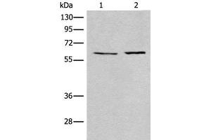 Western blot analysis of A172 and Jurkat cell lysates using USP14 Polyclonal Antibody at dilution of 1:400 (USP14 抗体)