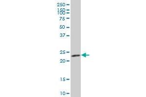 ARFRP1 polyclonal antibody (A01), Lot # ABNOVA060620QCS1 Western Blot analysis of ARFRP1 expression in HepG2 ( Cat # L019V1 ). (ARFRP1 抗体  (AA 133-201))
