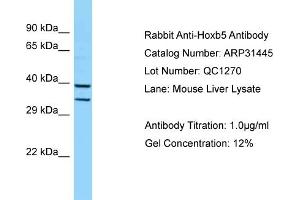 Western Blotting (WB) image for anti-Homeobox B5 (HOXB5) (Middle Region) antibody (ABIN2777304)