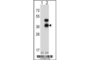 Western blot analysis of CD72 using rabbit polyclonal CD72 Antibody using 293 cell lysates (2 ug/lane) either nontransfected (Lane 1) or transiently transfected (Lane 2) with the CD72 gene. (CD72 抗体  (AA 176-203))