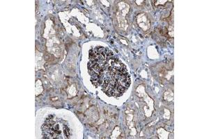 Immunohistochemical staining (Formalin-fixed paraffin-embedded sections) of human kidney with DYSF polyclonal antibody  shows strong positivity in the glomeruli and moderate membranous staining in tubular cells. (Dysferlin 抗体)