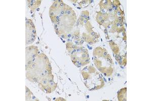 Immunohistochemistry of paraffin-embedded human stomach using RPLP1 antibody (ABIN5974064) at dilution of 1/100 (40x lens). (RPLP1 抗体)