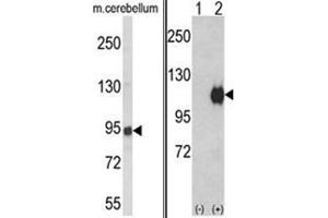(LEFT) Western blot analysis of ENPP2 Antibody (Center) in mouse cerebellum tissue lysates (35ug/lane).