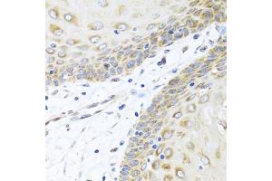 Immunohistochemistry of paraffin-embedded human esophagus using INHBC antibody (ABIN5975306) at dilution of 1/100 (40x lens). (INHBC 抗体)