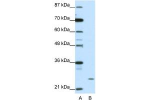 WB Suggested Anti-ZNF253 Antibody Titration:  1. (ZNF253 抗体  (C-Term))