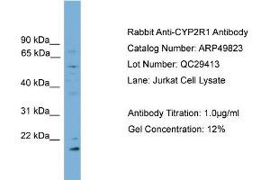 Western Blotting (WB) image for anti-Cytochrome P450, Family 2, Subfamily R, Polypeptide 1 (CYP2R1) (Middle Region) antibody (ABIN2783924)
