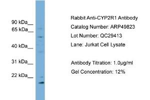 WB Suggested Anti-CYP2R1  Antibody Titration: 0. (CYP2R1 抗体  (Middle Region))