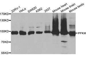 Western blot analysis of extracts of various cell lines, using PFKM antibody (ABIN5973190) at 1/1000 dilution. (PFKM 抗体)