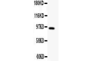 Anti- DISC1 antibody, Western blottingAll lanes: Anti DISC1  at 0. (DISC1 抗体  (Middle Region))