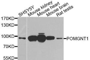 Western blot analysis of extracts of various cell lines, using POMGNT1 antibody (ABIN6003611) at 1/1000 dilution.
