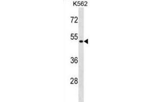 Western Blotting (WB) image for anti-Enolase Superfamily Member 1 (ENOSF1) antibody (ABIN2998739) (ENOSF1 抗体)
