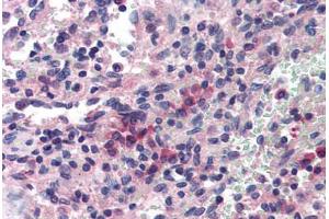 Human Spleen (formalin-fixed, paraffin-embedded) stained with SAE1 antibody ABIN214379 at 5 ug/ml followed by biotinylated goat anti-rabbit IgG secondary antibody ABIN481713, alkaline phosphatase-streptavidin and chromogen. (SAE1 抗体)