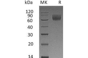 Western Blotting (WB) image for CD47 (CD47) protein (Fc Tag) (ABIN7321002) (CD47 Protein (CD47) (Fc Tag))