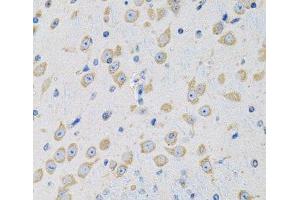 Immunohistochemistry of paraffin-embedded Mouse brain using MSRA Polyclonal Antibody at dilution of 1:100 (40x lens). (MSRA 抗体)