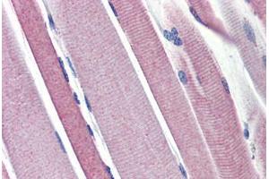 Human Skeletal Muscle (formalin-fixed, paraffin-embedded) stained with HK2 antibody ABIN462257 followed by biotinylated goat anti-rabbit IgG secondary antibody ABIN481713, alkaline phosphatase-streptavidin and chromogen. (Hexokinase 2 抗体  (AA 74-123))